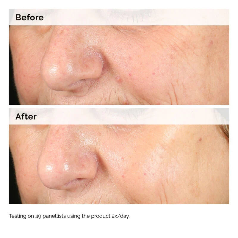 Alpha Arbutin 2% + HA Serum